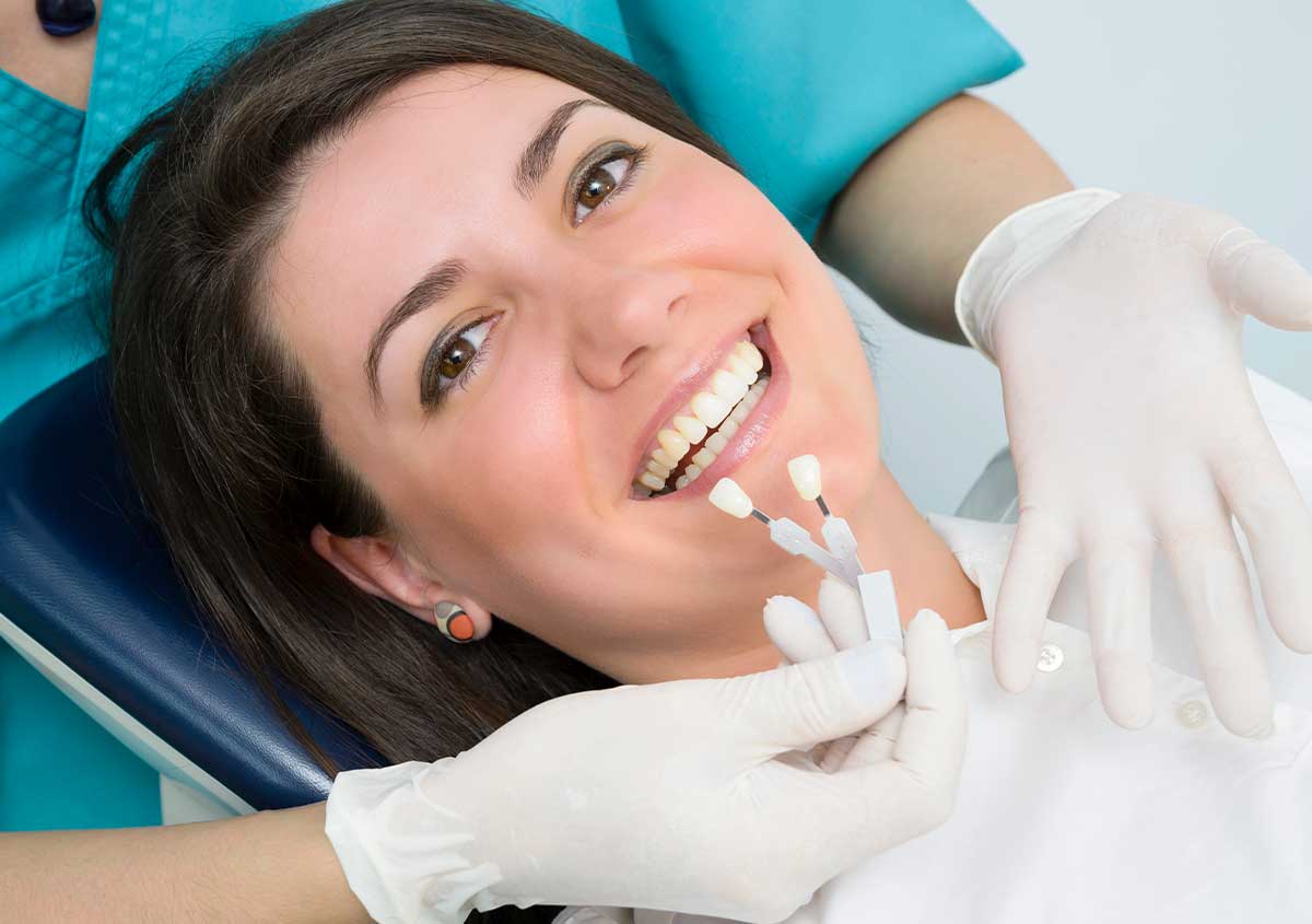 how long do veneers last valencia ca