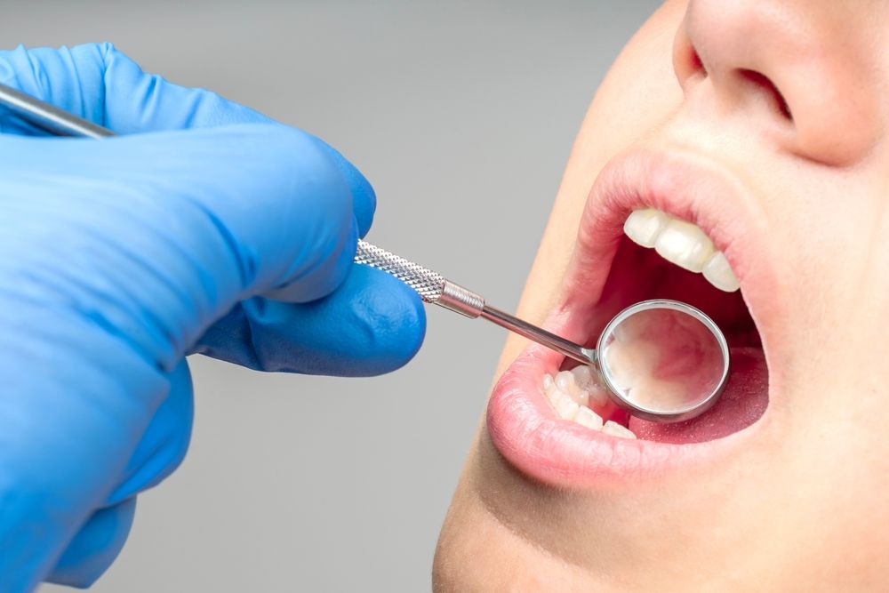 symptoms of periodontal disease