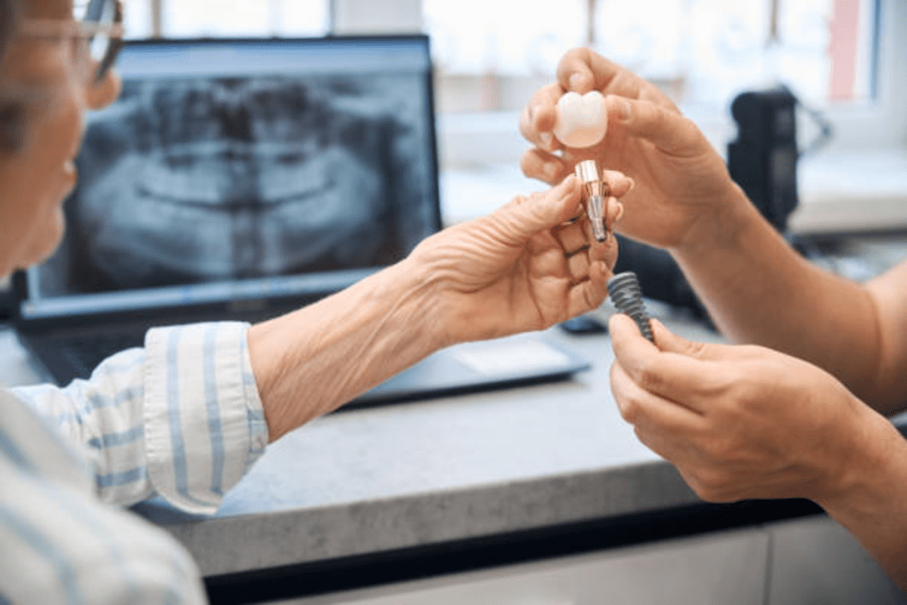 what to know dental implants